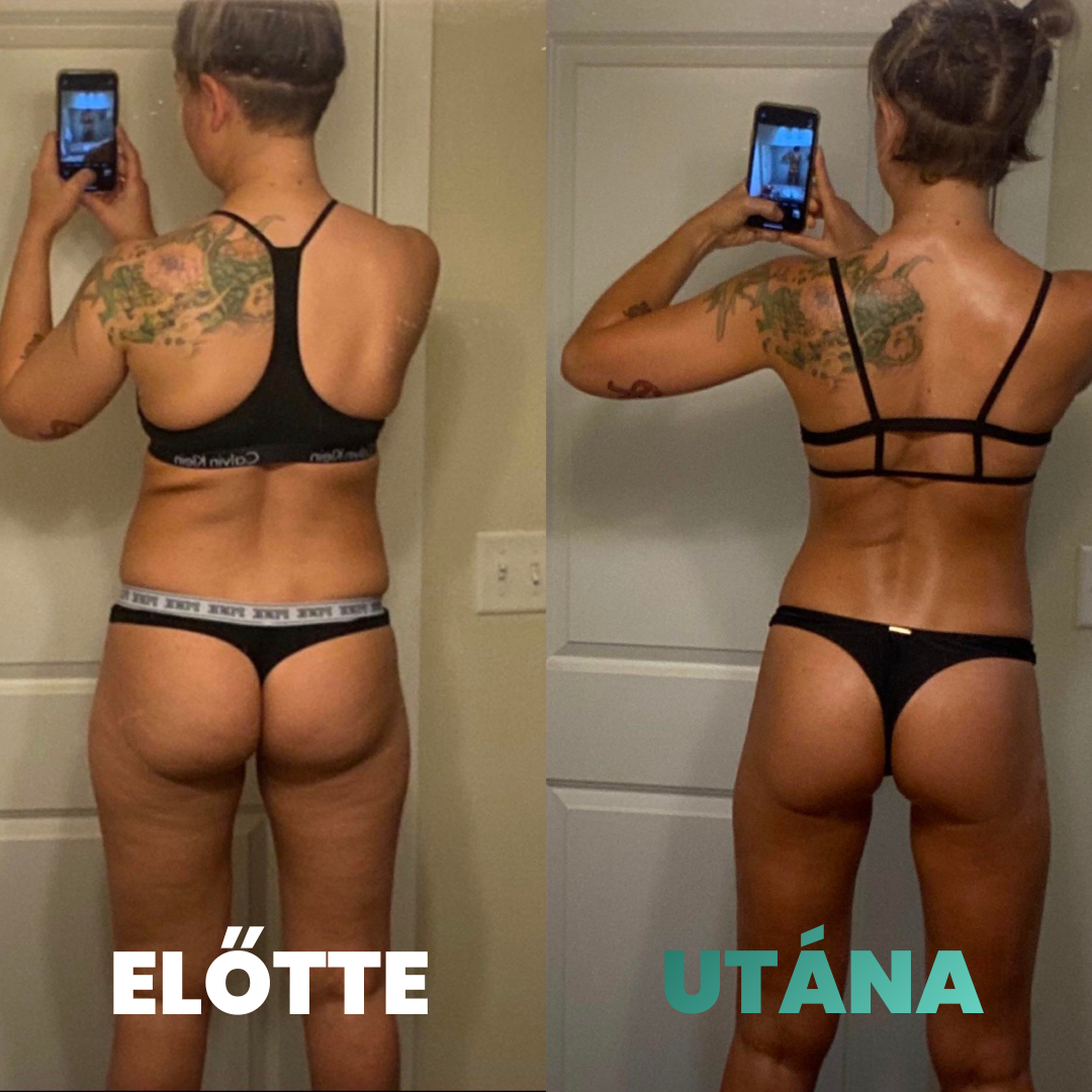 Skina SmoothSkin - Otthoni Megoldás Narancsbőr Ellen