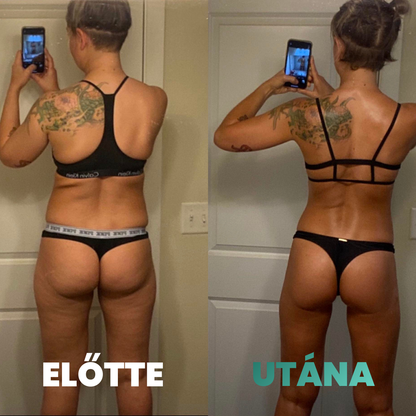 Skina SmoothSkin - Otthoni Megoldás Narancsbőr Ellen