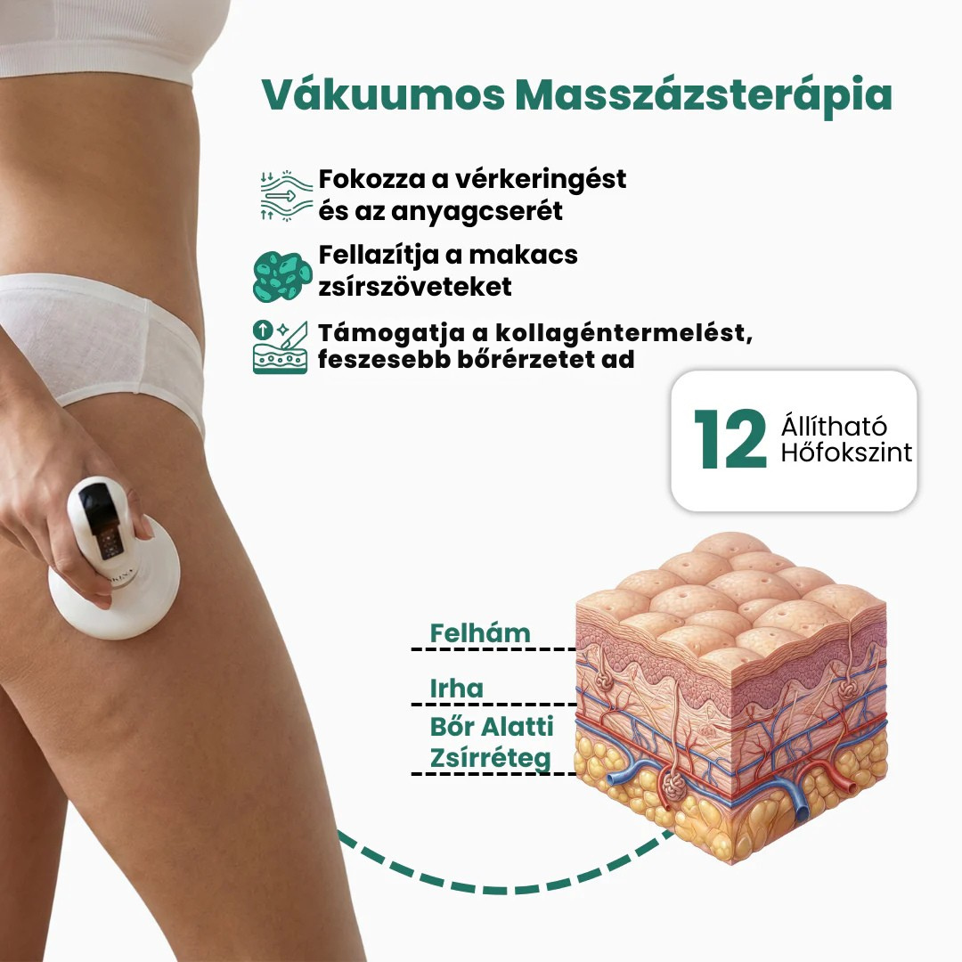 Skina SmoothSkin - Otthoni Megoldás Narancsbőr Ellen